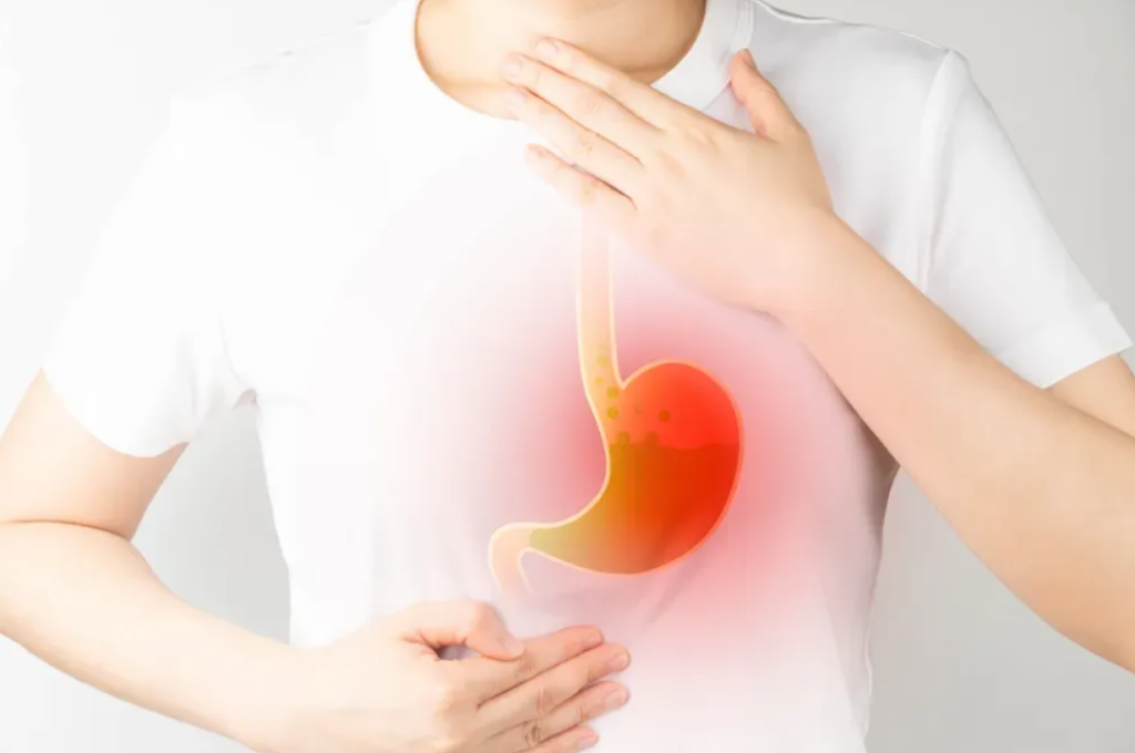 Acid reflux (GERD) Lifestyle Changes